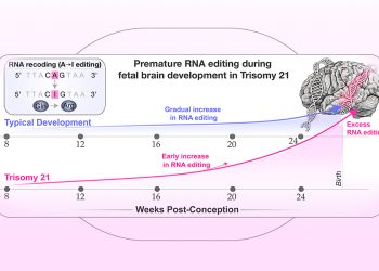 Съвместно научно изследване на учени от Медицински факултет „Икан“ в Mount Sinai, Института за изследване на мозъка „Либер“ и Университета на Аризона, САЩ, и Медицинския университет – София, идентифицира нов биологичен процес, който може да помогне да се обясни как мозъкът се развива различно при хора със синдром на Даун